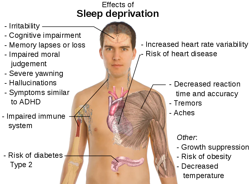 The Top 10 Effects of Sleep Loss