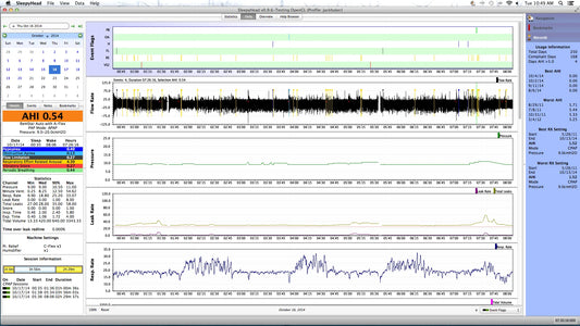 CPAP Data Analysis
