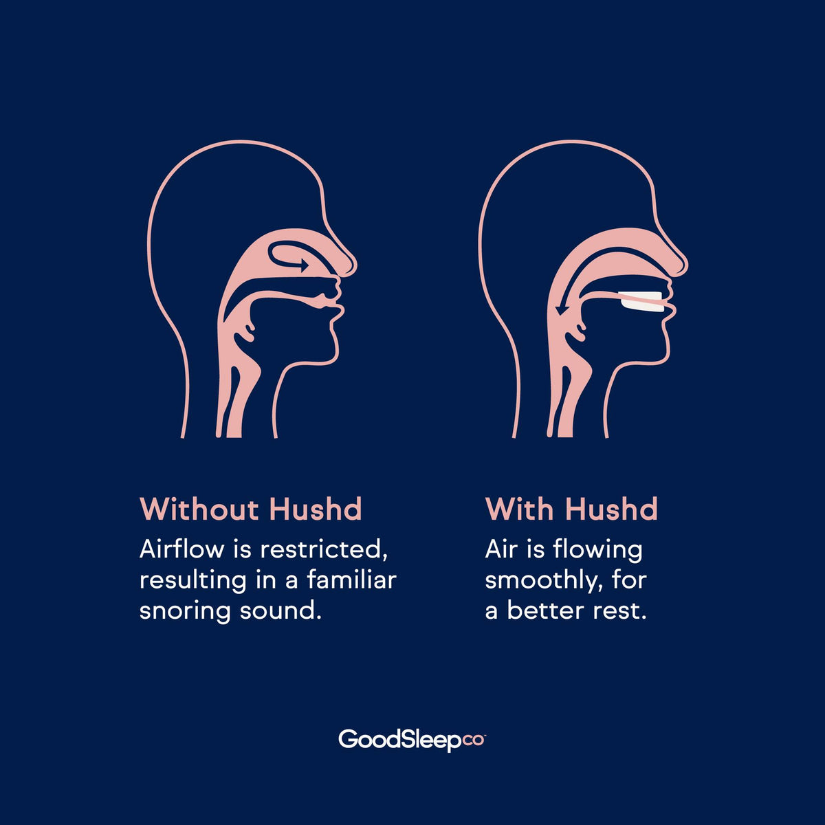 hushd - Digital Sleep Devices -  NSW CPAP